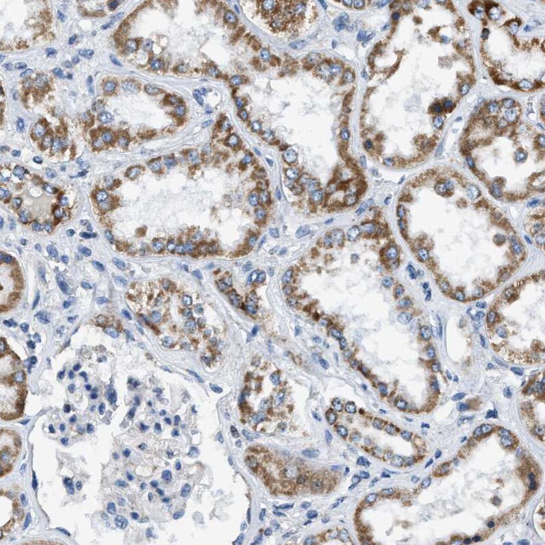 ACADVL Antibody - BSA Free Immunohistochemistry-Paraffin: ACADVL Antibody [NBP1-89287]