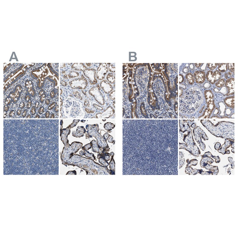 ACADVL Antibody - BSA Free Immunohistochemistry-Paraffin: ACADVL Antibody [NBP1-89287]