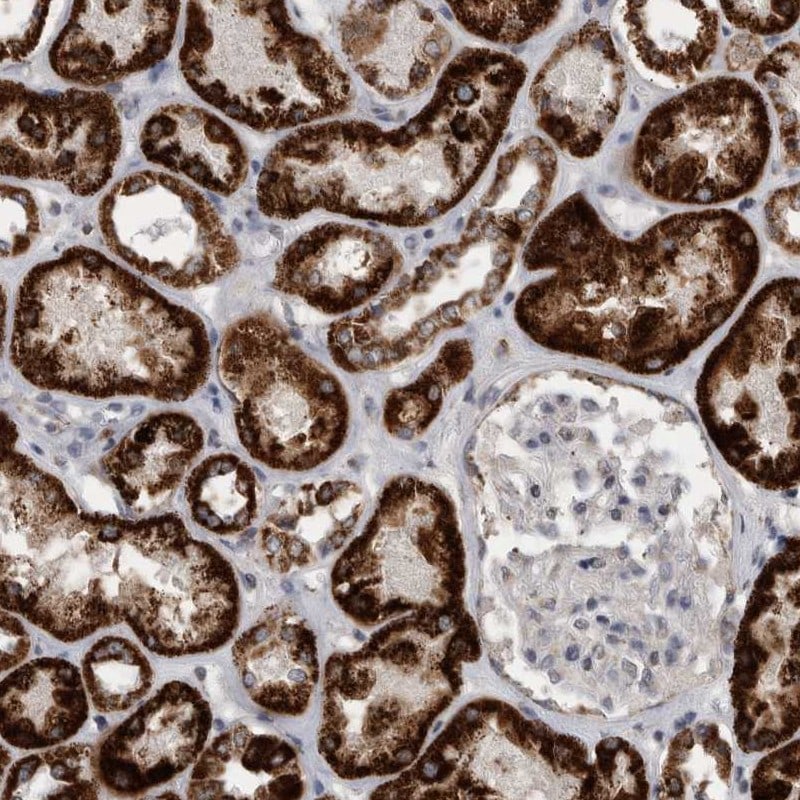ACADM Antibody - BSA Free Immunohistochemistry: ACADM Antibody [NBP1-89293]