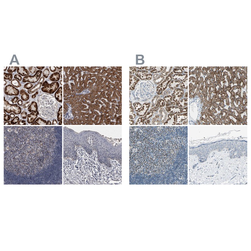 ACADM Antibody - BSA Free Immunohistochemistry: ACADM Antibody [NBP1-89293]