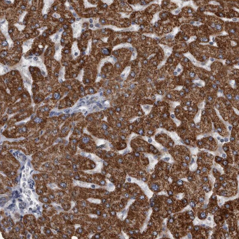 ACADM Antibody - BSA Free Immunohistochemistry: ACADM Antibody [NBP1-89293]