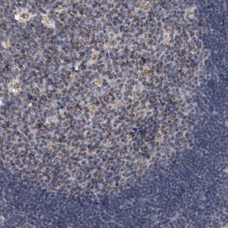 ACADM Antibody - BSA Free Immunohistochemistry: ACADM Antibody [NBP1-89293]