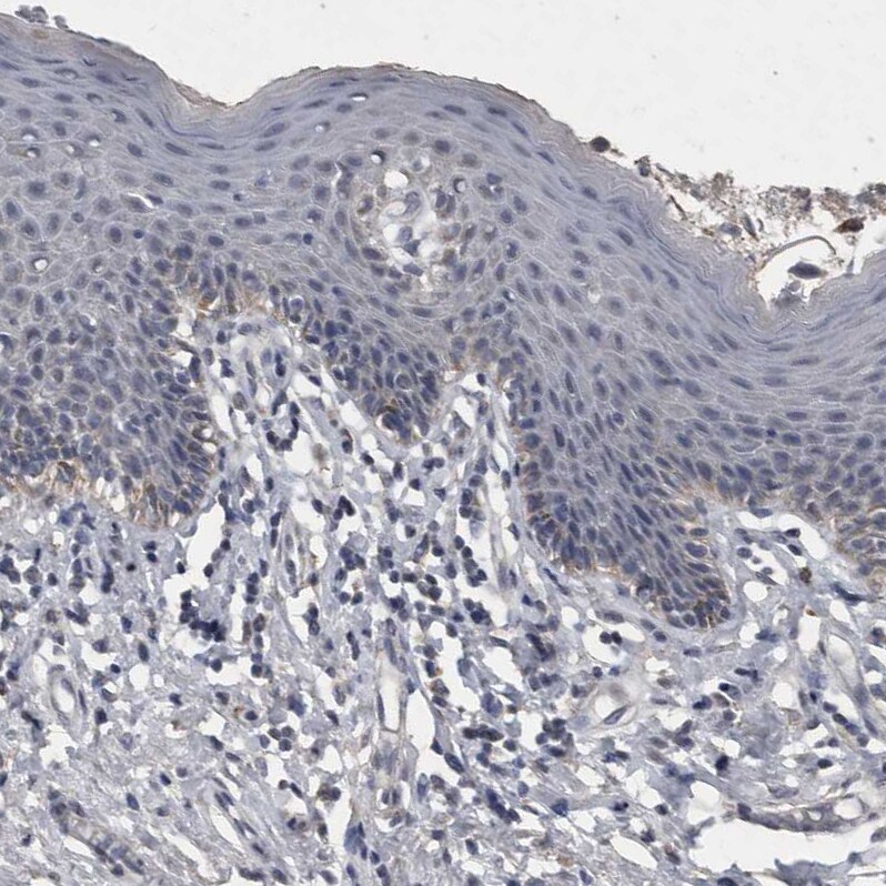 ACADM Antibody - BSA Free Immunohistochemistry: ACADM Antibody [NBP1-89293]