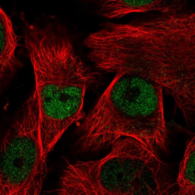 MORC2 Antibody - BSA Free Immunocytochemistry/ Immunofluorescence: MORC2 Antibody [NBP1-89295] -