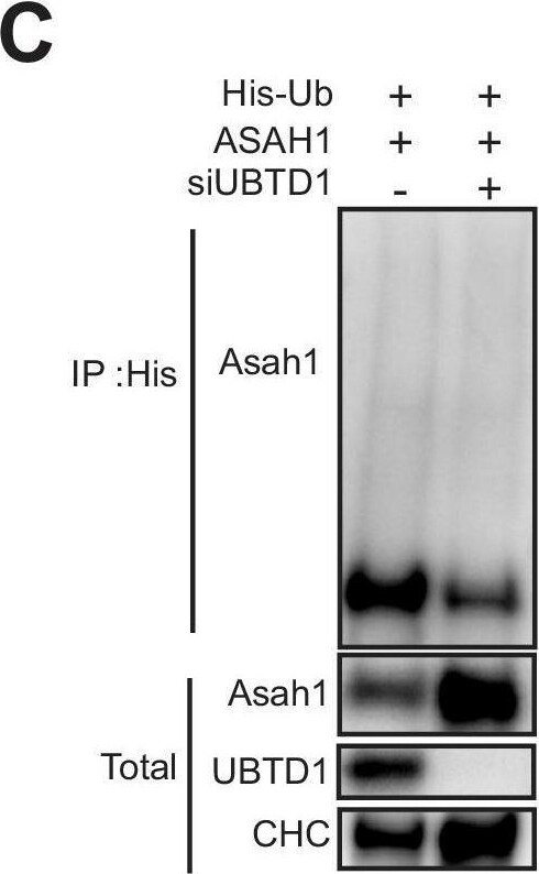 ASAH1 Antibody - BSA Free