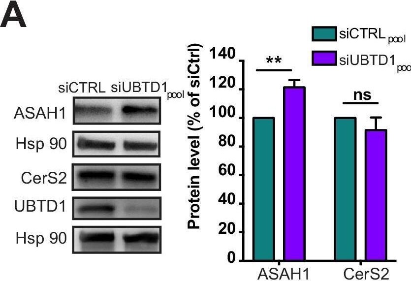 ASAH1 Antibody - BSA Free