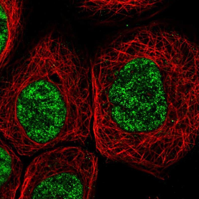 DDX41 Antibody - BSA Free Immunocytochemistry/ Immunofluorescence: DDX41 Antibody [NBP1-89297]