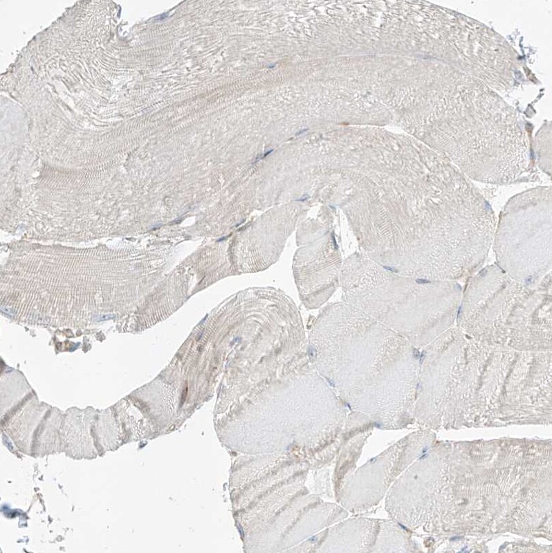 EPHX4 Antibody - BSA Free Immunohistochemistry-Paraffin: EPHX4 Antibody [NBP1-89307]
