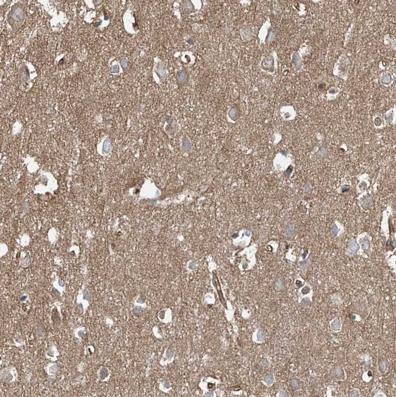 EPHX4 Antibody - BSA Free Immunohistochemistry-Paraffin: EPHX4 Antibody [NBP1-89307]