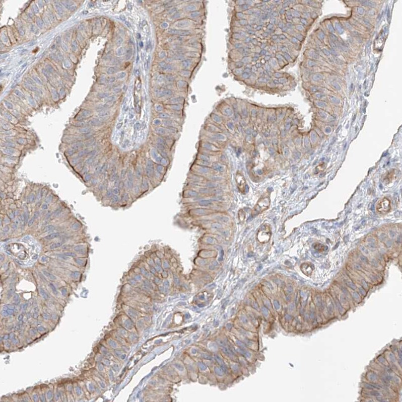 EPHX4 Antibody - BSA Free Immunohistochemistry-Paraffin: EPHX4 Antibody [NBP1-89307]