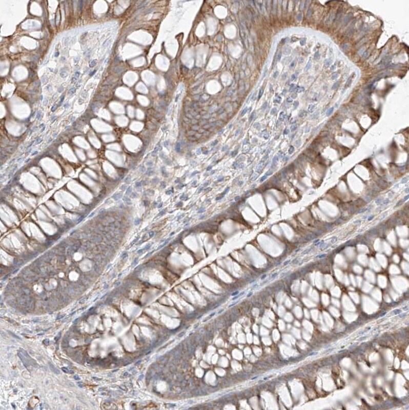 EPHX4 Antibody - BSA Free Immunohistochemistry-Paraffin: EPHX4 Antibody [NBP1-89307]