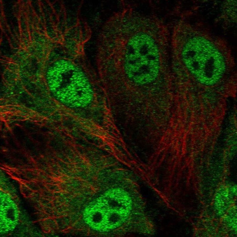 ABCA3 Antibody - BSA Free Immunocytochemistry/ Immunofluorescence: ABCA3 Antibody [NBP1-89310]