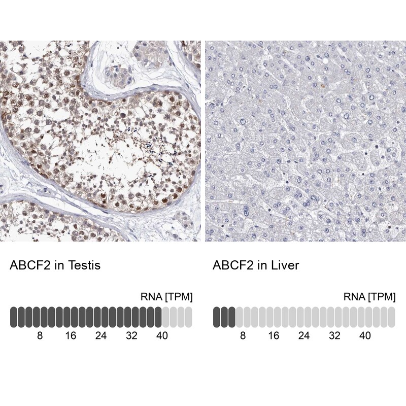 ABCF2 Antibody - BSA Free Immunohistochemistry-Paraffin: ABCF2 Antibody [NBP1-89316]