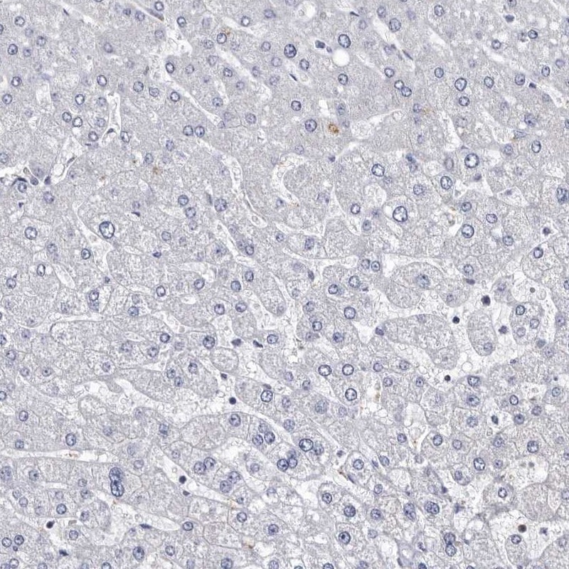 ABCF2 Antibody - BSA Free Immunohistochemistry-Paraffin: ABCF2 Antibody [NBP1-89316]