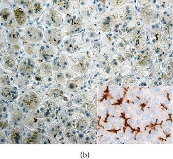 ABCB11 Antibody