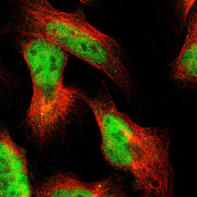 PRKAG2 Antibody - BSA Free Immunocytochemistry/ Immunofluorescence: PRKAG2 Antibody [NBP1-89324]