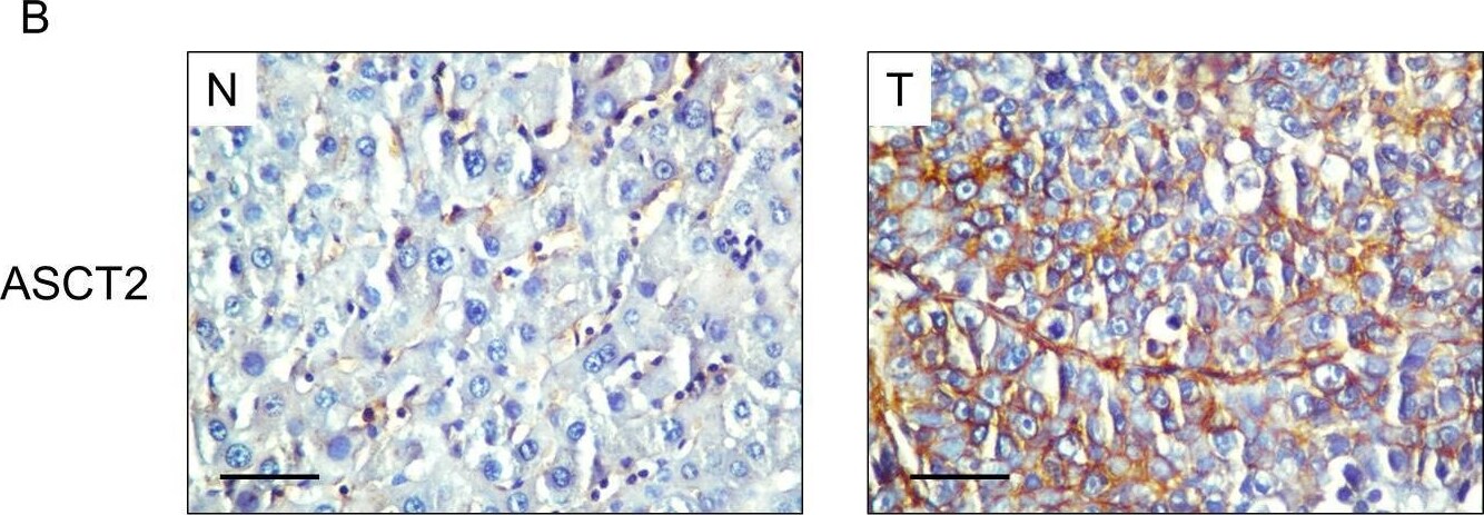 SLC1A5 Antibody - BSA Free