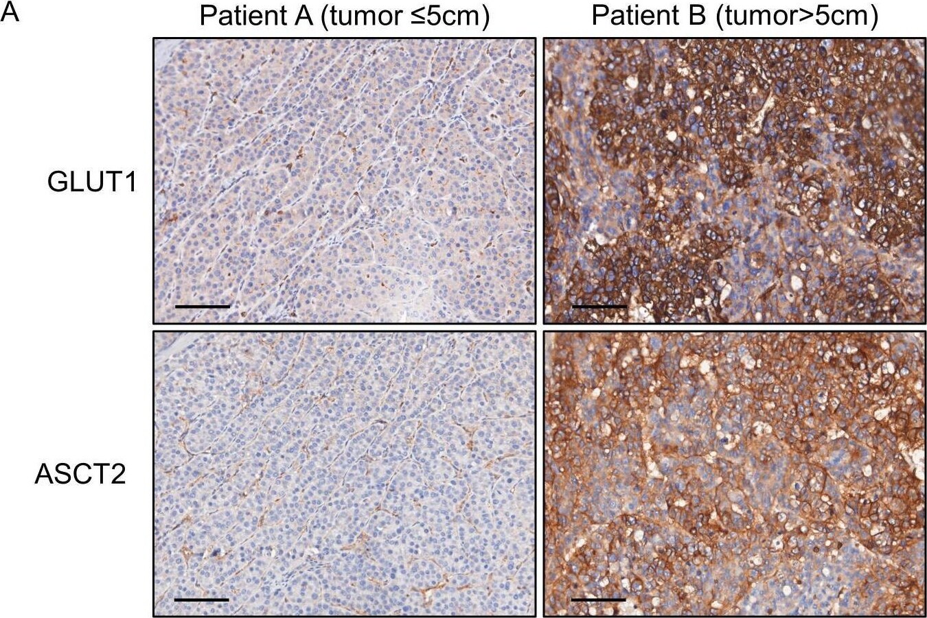 SLC1A5 Antibody - BSA Free