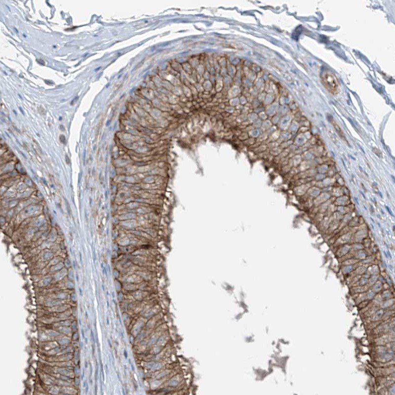 SLC1A5 Antibody - BSA Free Immunohistochemistry-Paraffin: SLC1A5 Antibody [NBP1-89328]