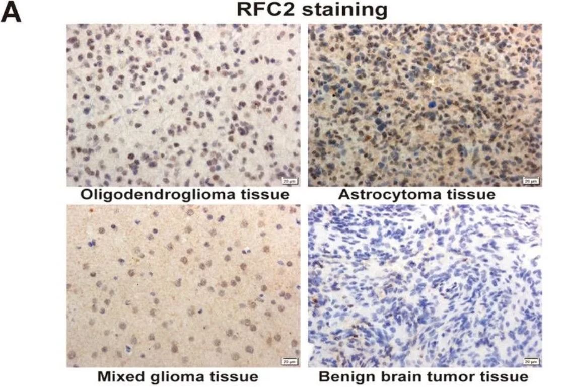 RFC2 Antibody