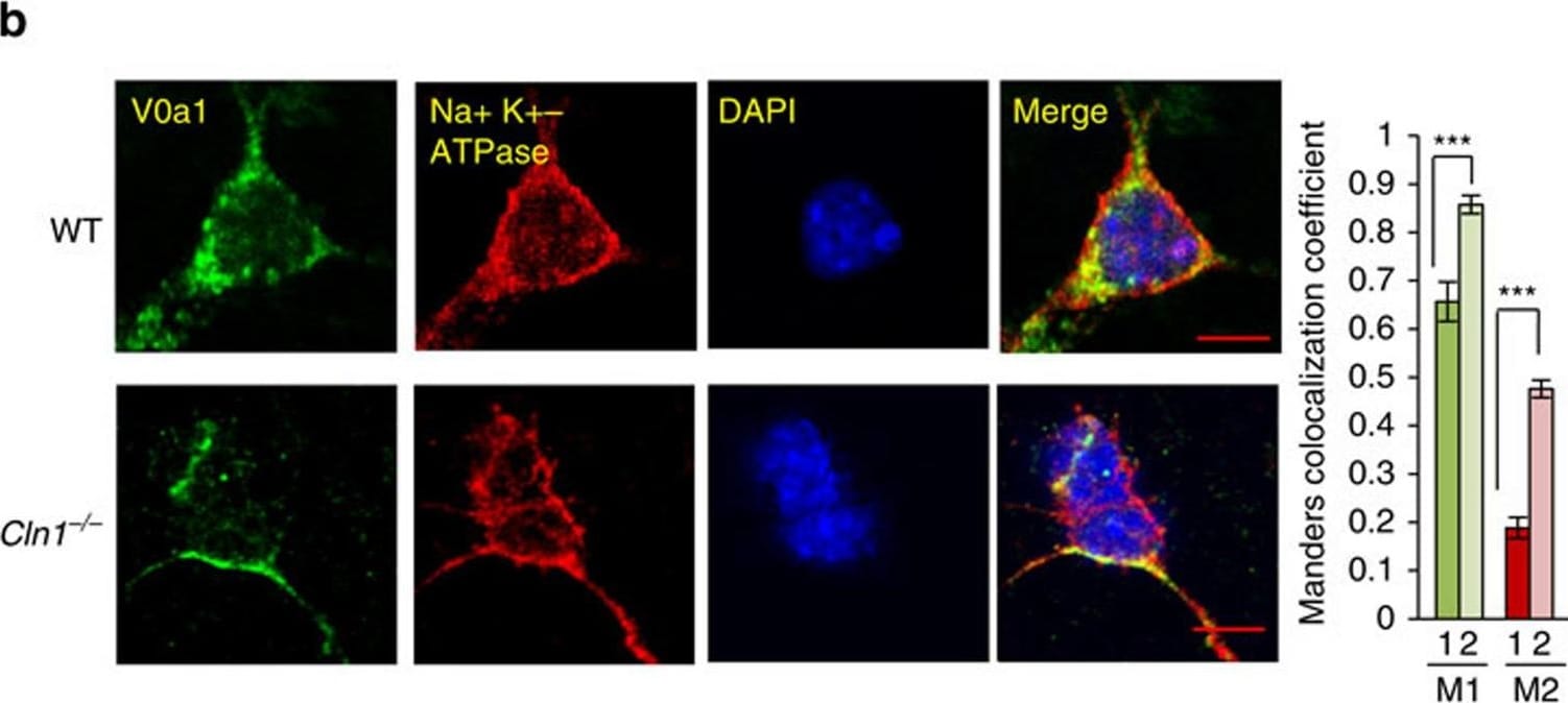 ATP6V0A1 Antibody