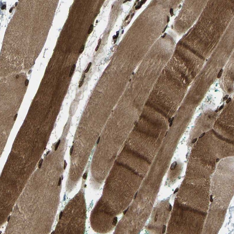 SYNE1 Antibody - BSA Free Immunohistochemistry-Paraffin: SYNE1 Antibody [NBP1-89349]