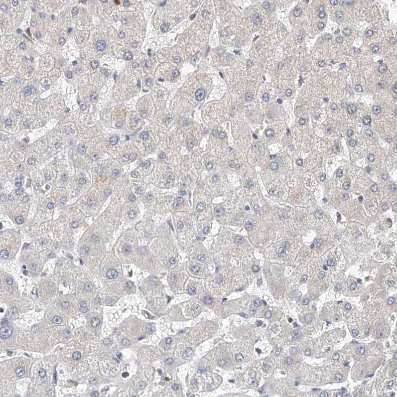 OFD1 Antibody - BSA Free Immunohistochemistry: OFD1 Antibody - BSA Free [NBP1-89354]