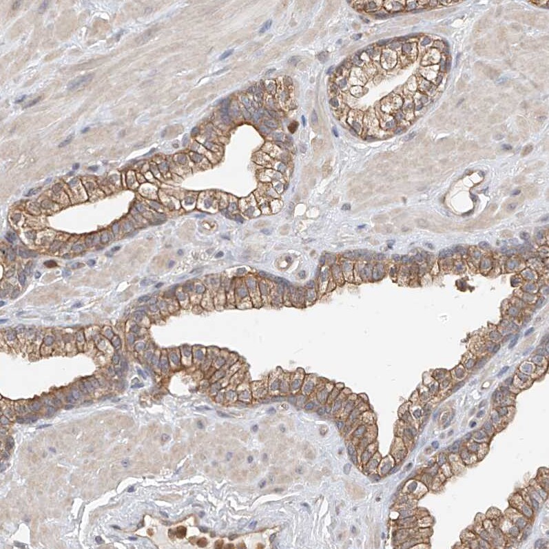 OFD1 Antibody - BSA Free Immunohistochemistry: OFD1 Antibody - BSA Free [NBP1-89354]