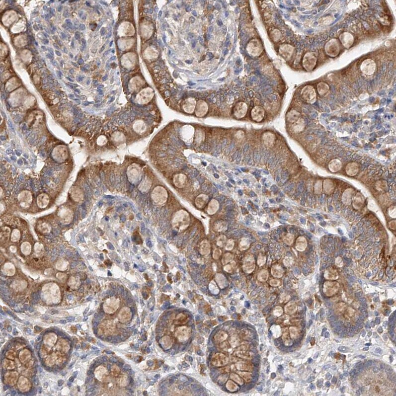 OFD1 Antibody - BSA Free Immunohistochemistry: OFD1 Antibody - BSA Free [NBP1-89354]
