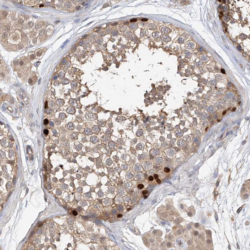OFD1 Antibody - BSA Free Immunohistochemistry: OFD1 Antibody - BSA Free [NBP1-89354]