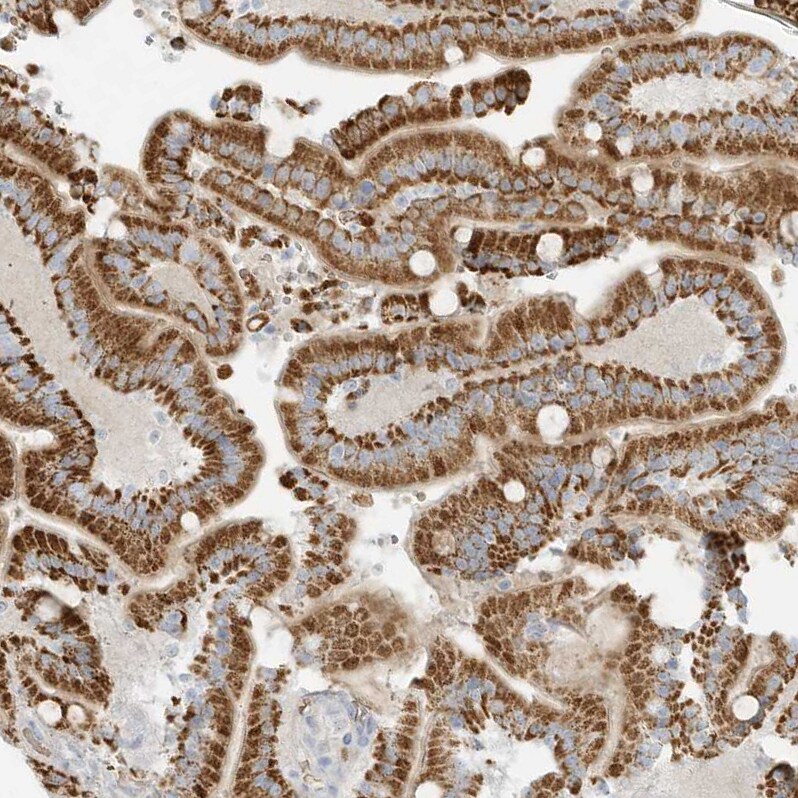 OFD1 Antibody - BSA Free Immunohistochemistry: OFD1 Antibody - BSA Free [NBP1-89356]