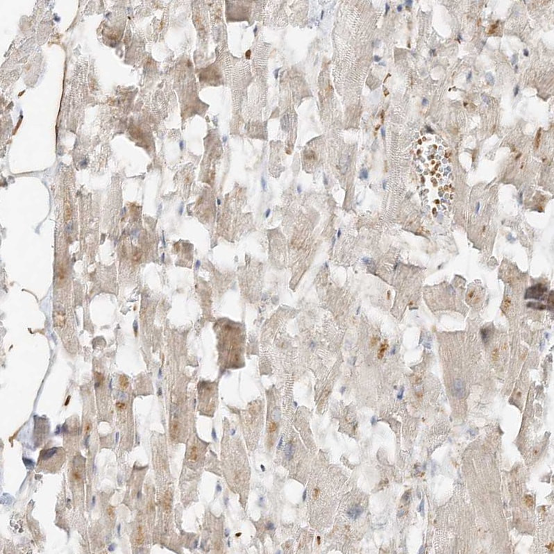 OFD1 Antibody - BSA Free Immunohistochemistry: OFD1 Antibody - BSA Free [NBP1-89356]