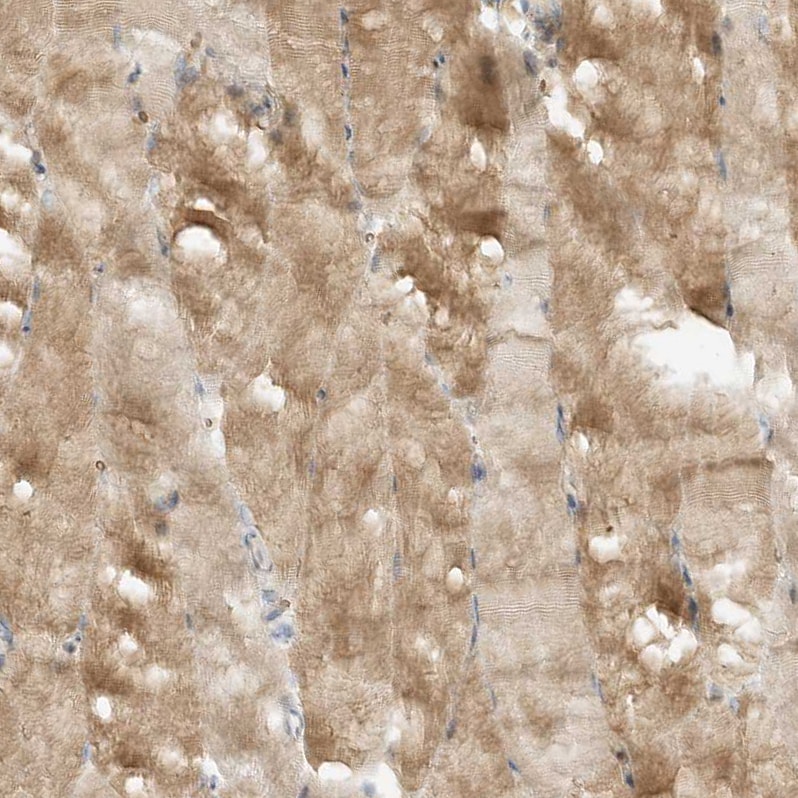 OFD1 Antibody - BSA Free Immunohistochemistry: OFD1 Antibody - BSA Free [NBP1-89356]