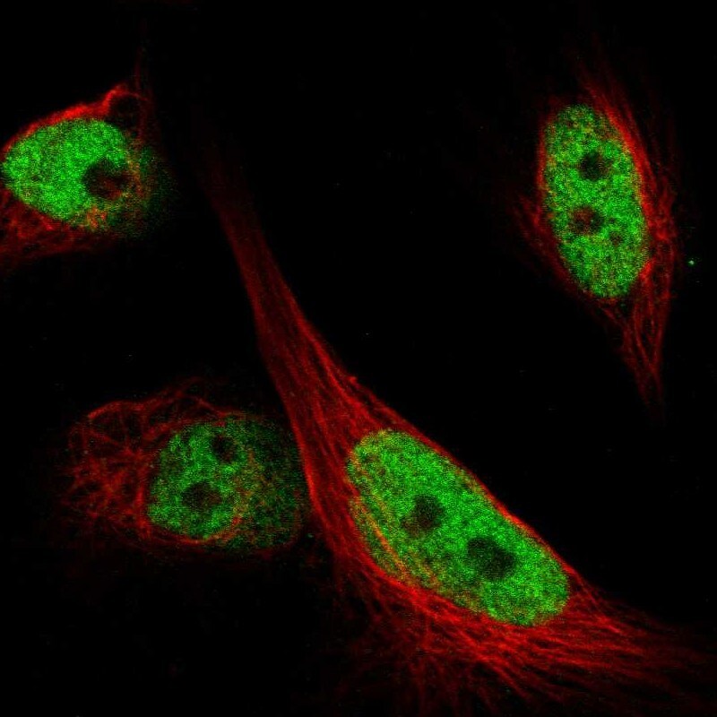 ARID1B Antibody - BSA Free Immunocytochemistry/ Immunofluorescence: ARID1B Antibody - BSA Free [NBP1-89358]