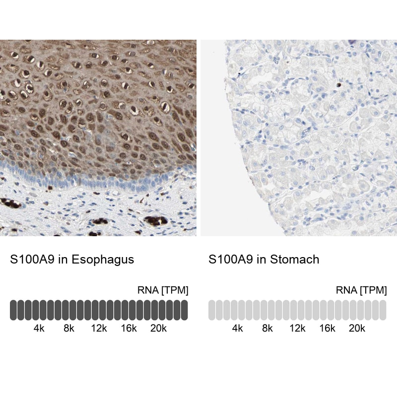 S100A9 Antibody - BSA Free Immunohistochemistry-Paraffin: S100A9 Antibody - BSA Free [NBP1-89360]
