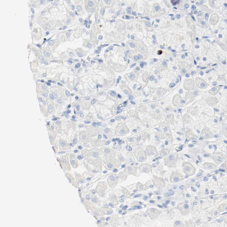 S100A9 Antibody - BSA Free Immunohistochemistry-Paraffin: S100A9 Antibody - BSA Free [NBP1-89360]