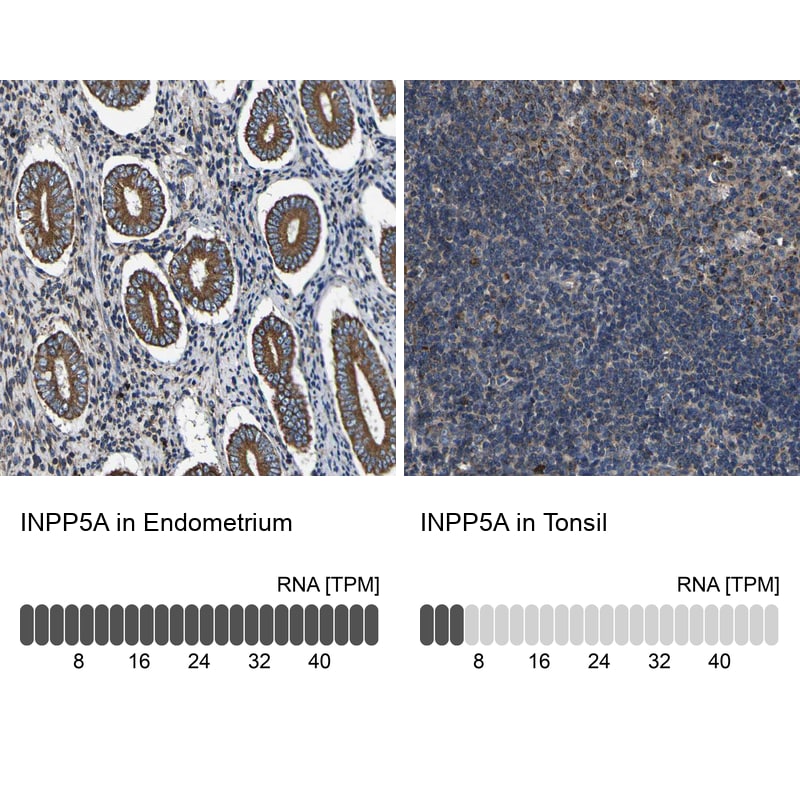 INPP5A Antibody - BSA Free Immunohistochemistry-Paraffin: INPP5A Antibody - BSA Free [NBP1-89361]