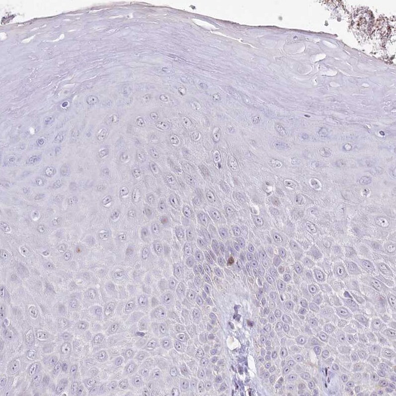 HPD Antibody - BSA Free Immunohistochemistry-Paraffin: HPD Antibody - BSA Free [NBP1-89366]