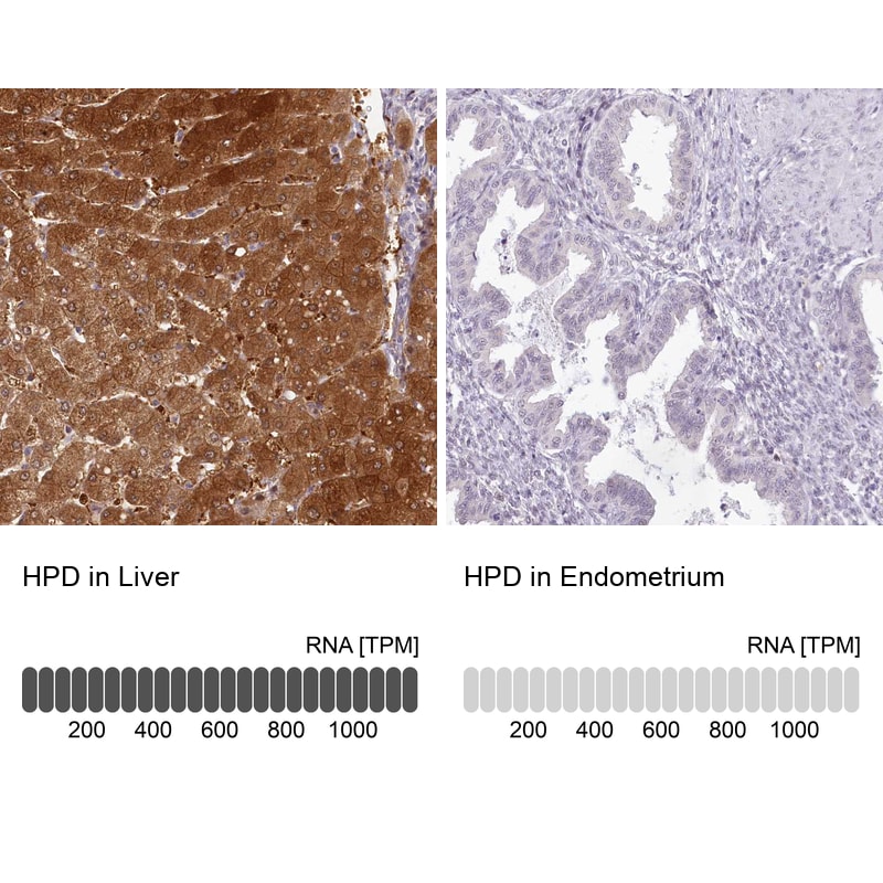 HPD Antibody - BSA Free Immunohistochemistry-Paraffin: HPD Antibody - BSA Free [NBP1-89366]