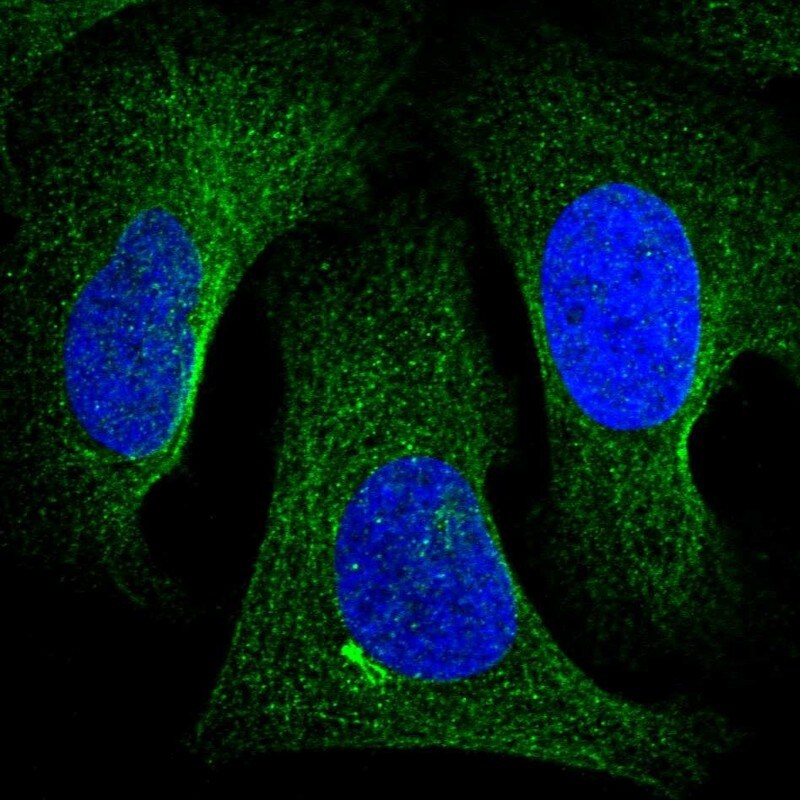 TNKS2 Antibody Immunocytochemistry/ Immunofluorescence: TNKS2 Antibody [NBP1-80946]