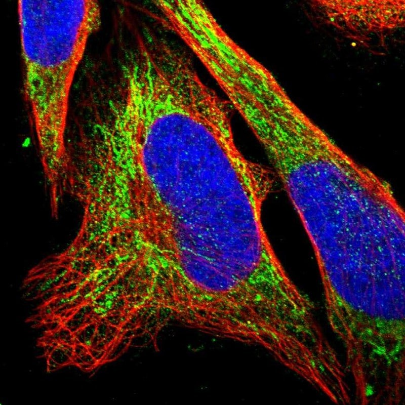 EIF4E2 Antibody Immunocytochemistry/ Immunofluorescence: EIF4E2 Antibody [NBP1-89367]