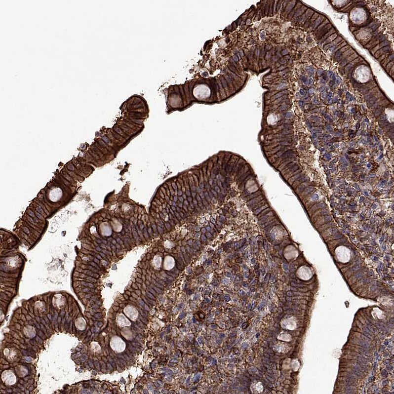 S100A10 Antibody - BSA Free Immunohistochemistry-Paraffin: S100A10 Antibody - BSA Free [NBP1-89370]