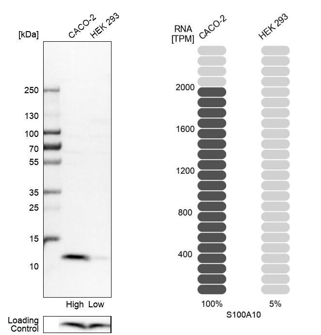 S100A10 Antibody - BSA Free Western Blot: S100A10 Antibody - BSA Free [NBP1-89370]