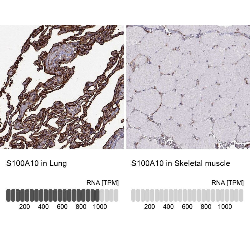 S100A10 Antibody - BSA Free Immunohistochemistry-Paraffin: S100A10 Antibody - BSA Free [NBP1-89370]