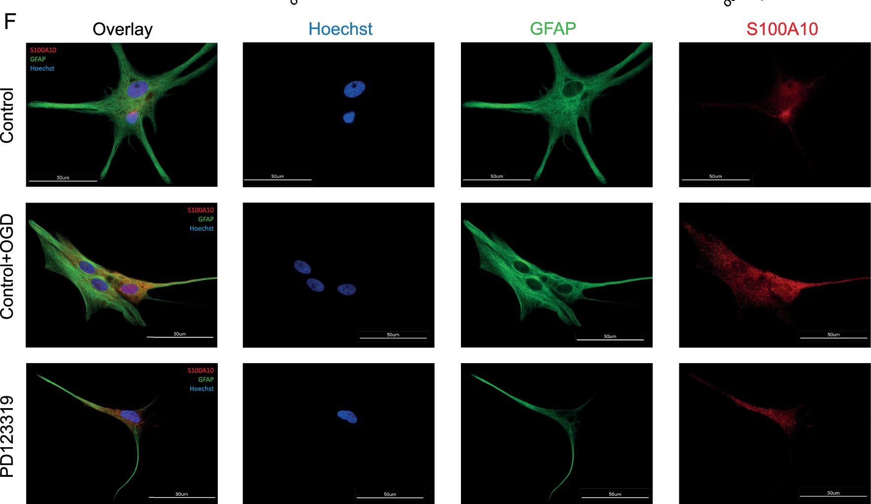 S100A10 Antibody - BSA Free