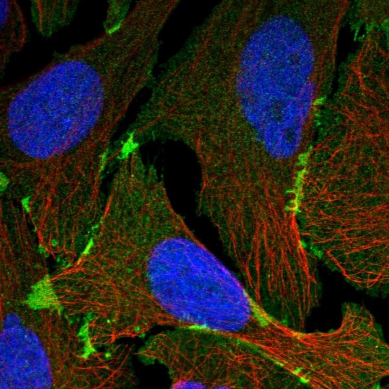 EPB41L3 Antibody - BSA Free Immunocytochemistry/ Immunofluorescence: EPB41L3 Antibody - BSA Free [NBP1-89372]