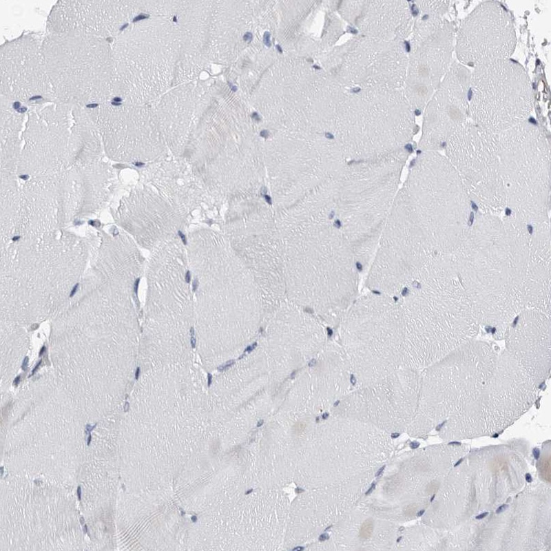 EPB41L3 Antibody - BSA Free Immunohistochemistry-Paraffin: EPB41L3 Antibody - BSA Free [NBP1-89372]
