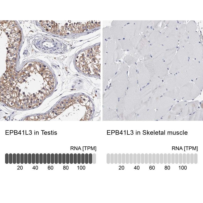 EPB41L3 Antibody - BSA Free Immunohistochemistry-Paraffin: EPB41L3 Antibody - BSA Free [NBP1-89372]