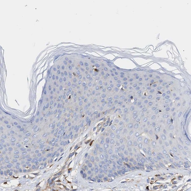 HS3ST5 Antibody - BSA Free Immunohistochemistry-Paraffin: HS3ST5 Antibody - BSA Free [NBP1-89373]