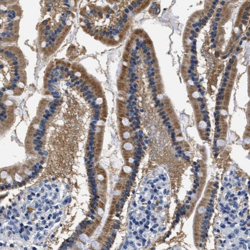 HS3ST2 Antibody - BSA Free Immunohistochemistry-Paraffin: HS3ST2 Antibody - BSA Free [NBP1-89374]